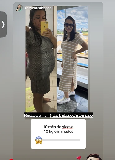 antesxdepois3