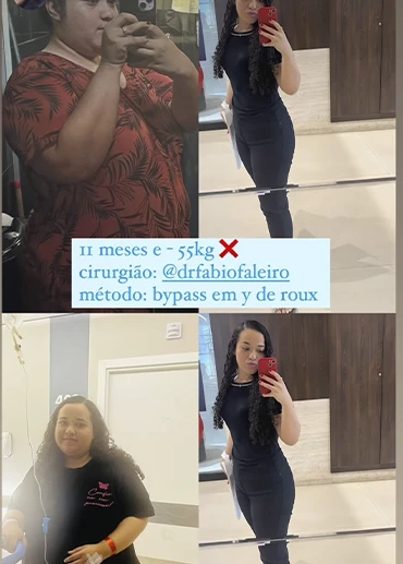antesxdepois9